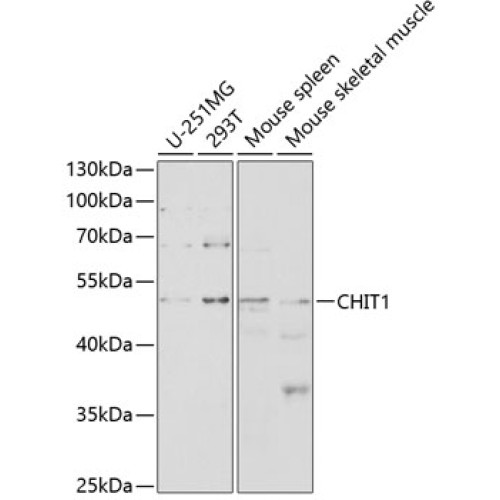 CHIT1 Rabbit pAb