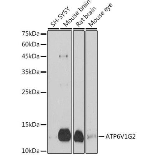 ATP6V1G2 Rabbit pAb
