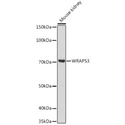 WRAP53 Rabbit pAb
