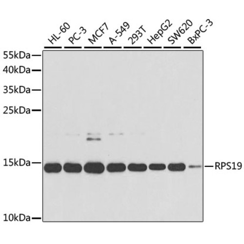 RPS19 Rabbit pAb