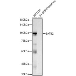 SATB2 Rabbit mAb