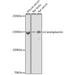Ceruloplasmin Rabbit mAb