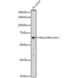 Neurofilament L Rabbit mAb