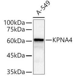 KPNA4 Rabbit pAb