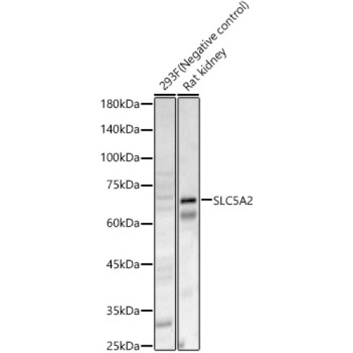 SLC5A2 Rabbit pAb