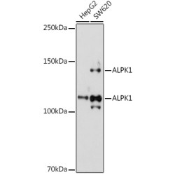 ALPK1 Rabbit pAb