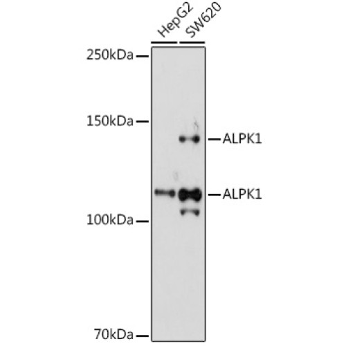 ALPK1 Rabbit pAb