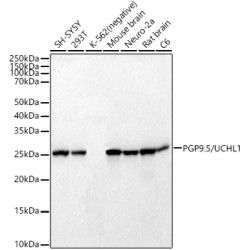PGP9.5/UCHL1 Rabbit mAb