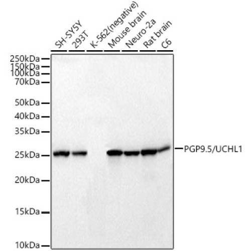 PGP9.5/UCHL1 Rabbit mAb