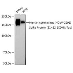 HCoV-229E Spike S2 Rabbit pAb