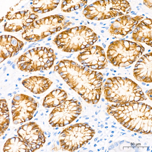 Claudin18.2 Rabbit mAb