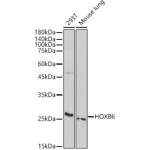 HOXB6 Rabbit pAb