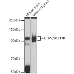 CTIP2/BCL11B Rabbit pAb