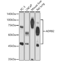 ADRB2 Rabbit pAb