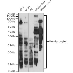 Pan-Succinyl-K Rabbit pAb