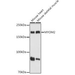 MYOM2 Rabbit pAb