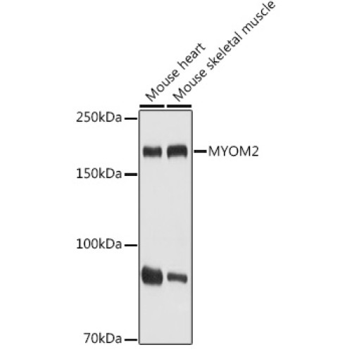 MYOM2 Rabbit pAb