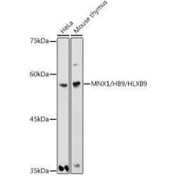 MNX1/HB9/HLXB9 Rabbit pAb