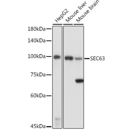 SEC63 Rabbit pAb