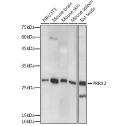 PRRX2 Rabbit pAb