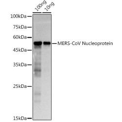 MERS-CoV Nucleoprotein Rabbit pAb