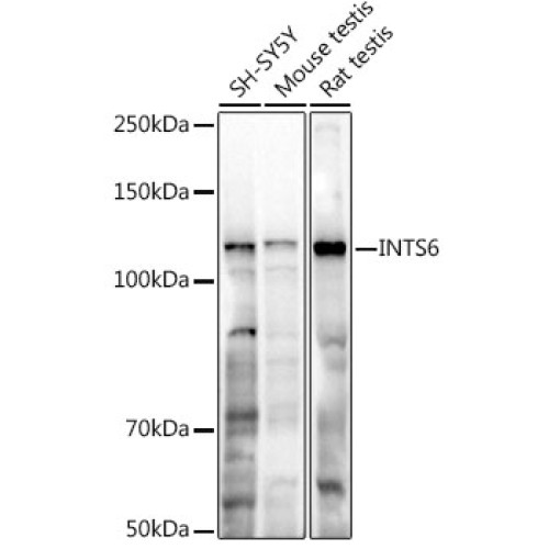INTS6 Rabbit pAb