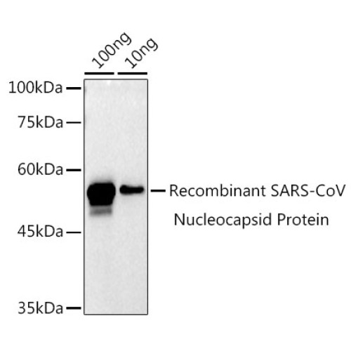 SARS-CoV-2 N Protein Rabbit pAb