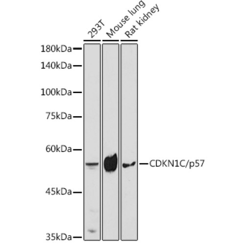 CDKN1C/p57 Kip2 Rabbit pAb