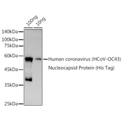 HCoV-OC43 Nucleoprotein Rabbit pAb
