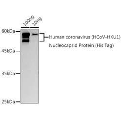 HCoV-HKU1 Nucleoprotein Rabbit pAb