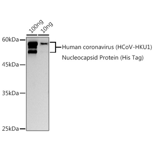 HCoV-HKU1 Nucleoprotein Rabbit pAb