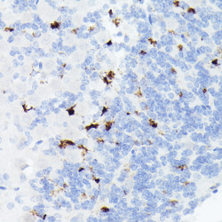 Somatostatin (SST) Rabbit mAb