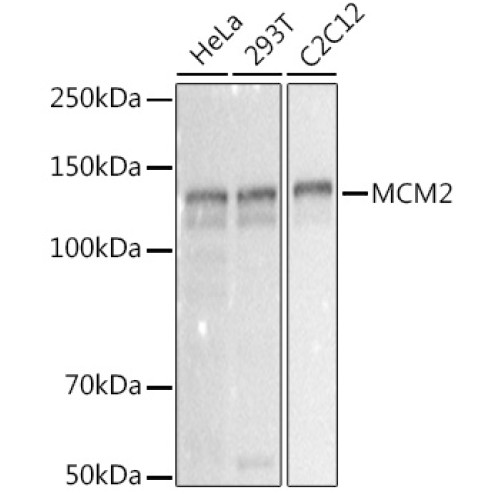 MCM2 Rabbit mAb