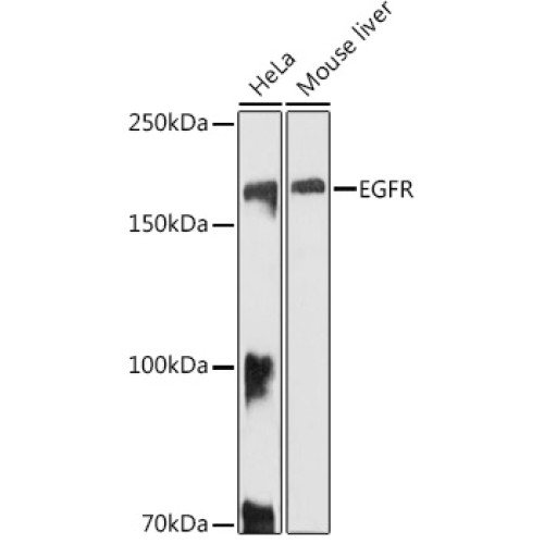 EGFR Rabbit pAb