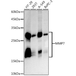 MMP7 Rabbit mAb