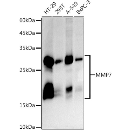 MMP7 Rabbit mAb