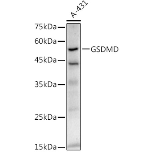 GSDMD (Full length+C terminal) Rabbit mAb