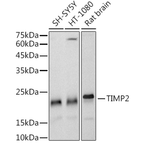 TIMP2 Rabbit mAb
