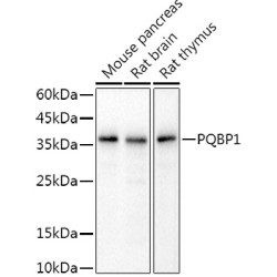 PQBP1 Rabbit mAb