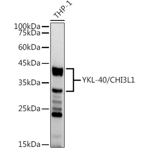 YKL-40/CHI3L1 Rabbit mAb