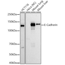 E-Cadherin Rabbit mAb