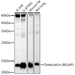 Osteocalcin (BGLAP) Rabbit mAb