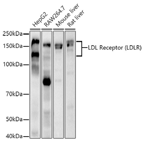 LDL Receptor (LDLR) Rabbit mAb