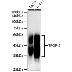 TROP-2 Rabbit mAb