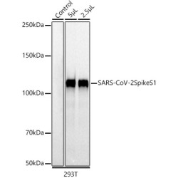 SARS-CoV-2 Spike S1 Rabbit mAb
