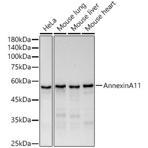Annexin A11  Rabbit mAb