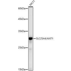 [KO Validated] SLC25A4/ANT1 Rabbit mAb