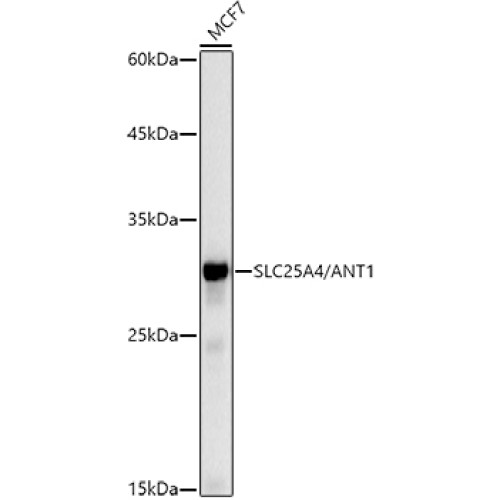[KO Validated] SLC25A4/ANT1 Rabbit mAb