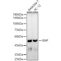[KO Validated] XIAP Rabbit mAb