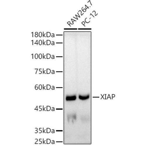[KO Validated] XIAP Rabbit mAb